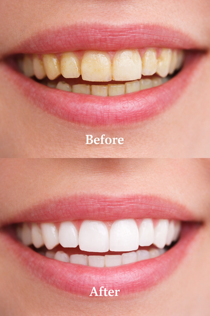 Rasyan Herbal Clove Toothpaste