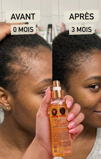 HAIR TONIC GENIVE ORIGINAL